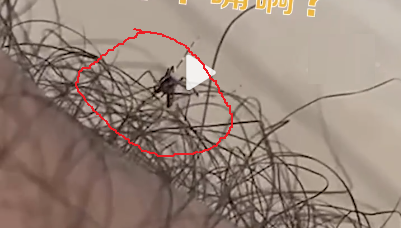 樂一樂|防蚊小妙招，長腿毛竟成為“防蚊神器”！-東方漢諾-北京快訊